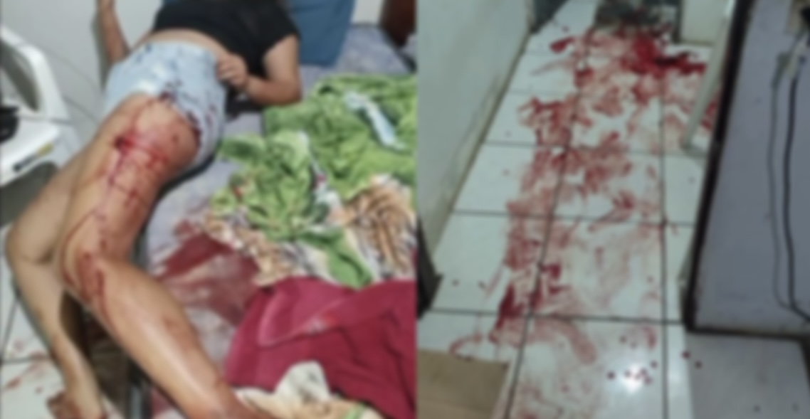 Amaziado tenta matar companheira com 3 facadas e foge do flagrante