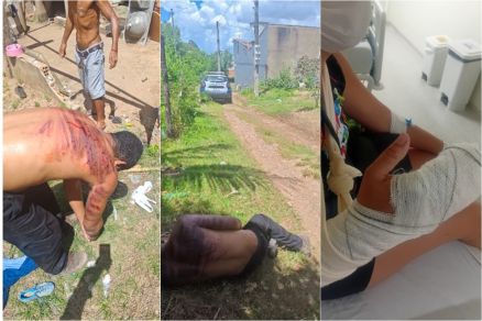 FEMINICÍDIO: homem leva salve de facção após agredir ex-companheira em Cuiabá